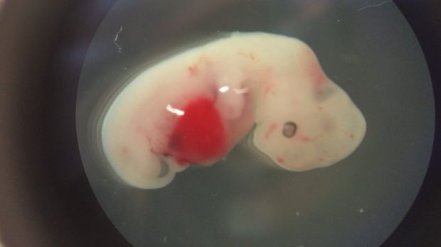 A four-week-old human-pig embryo.