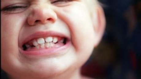 Milk teeth are vital for your child's health and development.