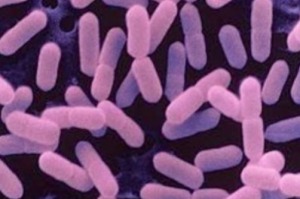 Listeria are bacteria that can cause a serious illness called listeriosis in some people.