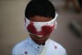 A boy with fake blood on his face and clothes to represent a victim participates in a protest against Saudi-led ...