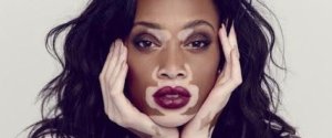 Chantelle Winnie