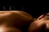 A study of 600 women by doctors at the Adelaide Women and Children's Hospital found that acupuncture can reduce the ...