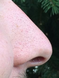 Nose Example.jpg