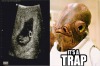 Admiral Akbar (<a href="http://thumbpress.com/20-funniest-ultrasound-pictures/">img</a>)