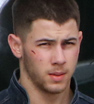 On set: Nick Jonas appeared bruised and battered as he filmed his latest project on location in Venice