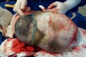 The amazing birth was captured on camera. 