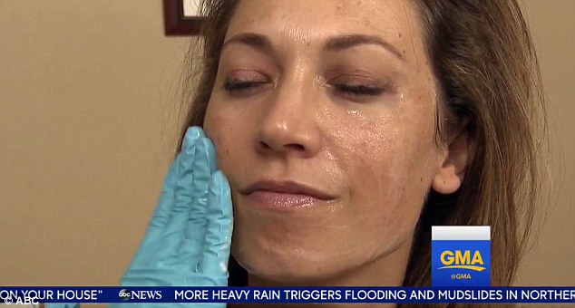 Under control: Dr. Bowe started Ginger off with a gentle chemical peel, and the TV star was told to amp up her sun protection 