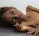 Five-year-old Mohannad Ali lies on a hospital bed in Abs, Yemen, in December. His two-year-old cousin died of hunger.