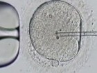 Closeup down microscope of fine needle pierced into a single egg. 