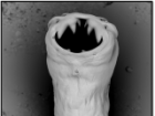 Ancylostoma caninum, the dog hookworm