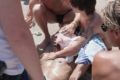 Beachgoers hold a towel to the head of a man who was attacked at Bondi on Thursday.