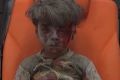 Omran Daqneesh, the child whose image has defined the misery of Aleppo for many. His 10-year-old brother died from ...