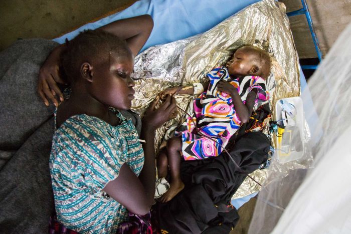 A young girl lies beside a malnourished infant on a intravenous drip in South Sudan.