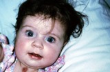 Kirsty Collier two months after her operation in February 1999. Kirsty had a third of her heart removed when she was ...