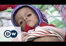 Under Saudi Bombardment, 33% of Yemenis Food Insecure