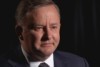 Anthony Albanese