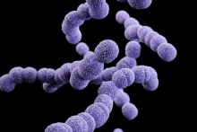 Streptococcus agalactiae (Supplied: Centers for Disease Control)