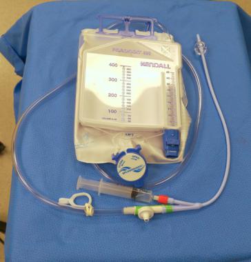 Միզային կաթետր (urinary catheter)