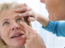 Causes and treatments for blood shot eyes