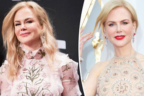 Nicole Kidman plastic surgeon fillers fuller face furore