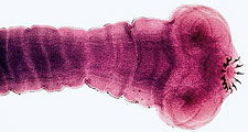 Scolex (head) of the tapeworm Taenia solium.  The hooks of the scolex enable the tapeworm to attach to the intestinal wall.