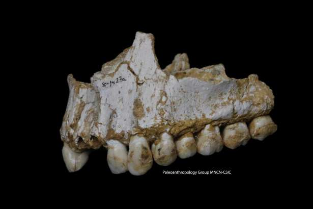 This photo provided by Paleoanthropology Group MNCN-CSIC  shows an El Sidron upper jaw: a dental calculus deposit is visible on the rear molar, right, of this Neanderthal. This individual was eating poplar, a source of aspirin, and had also consumed moulded vegetation including Penicillium fungus, source of a natural antibiotic. Scientists got a sneak peek into the kitchen and medicine cabinets of three Neanderthals by examining the DNA of the stuff stuck on and between their teeth. What they found smashes a common meaty misconception of the caveman diet and hints that one sickly Neanderthal had found what may be primitive versions of penicillin and aspirin to help him with his pain. (Paleoanthropology Group MNCN-CSIC via AP)