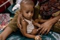 An infant cholera patient with his mother in the general hospital ward at the ICDDR,B.