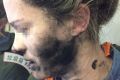 The woman was badly burnt when her headphones exploded on a flight from Beijing to Melbourne.