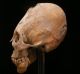 Huns and other nomadic populations in central Asia sometimes bound infants' skulls to modify their shapes.