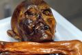 The 5300-year-old mummy known as Otzi the Iceman. 