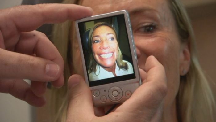 Susie Robinson gets a 3D printed jaw implant