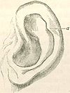 1871 Descent F937.1 fig03.jpg