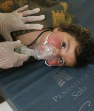 A Syrian doctor treating a child following a suspected chemical attack, at a makeshift hospital, in the town of Khan ...