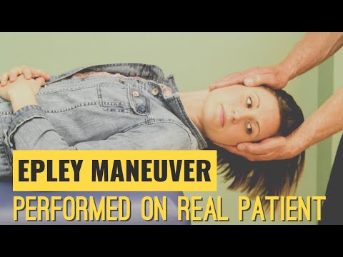 Epley Maneuver: Performed on a Real Patient suffering from Vertigo