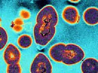 Vancomycin resistant enterococci (VRE) bacteria, a life-threatening superbug as viewed under a microscope in 2005 image.