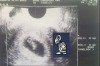 This early scan looks destinctly like the Mario Bros turtle... (<a ...