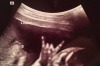 <b>FUNNY ULTRASOUND PICS:</b> <a href="http://www.lostboysarewe.com/">Blogger Makelle Ahlin</a> shared a photo of her ...