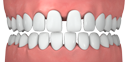 Bite uneven 575c28a754d53a56e3cd2aa7c216d2ee90e7ae767a7e9b282311485dcf950d6f