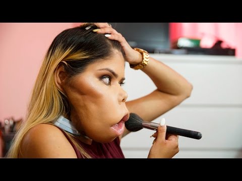 Inspirational Vlogger Redefines Beauty: BORN DIFFERENT