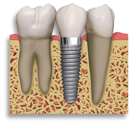 Cosmetic Dentistry