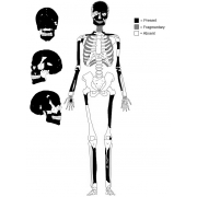 Graphic of skeleton and skull