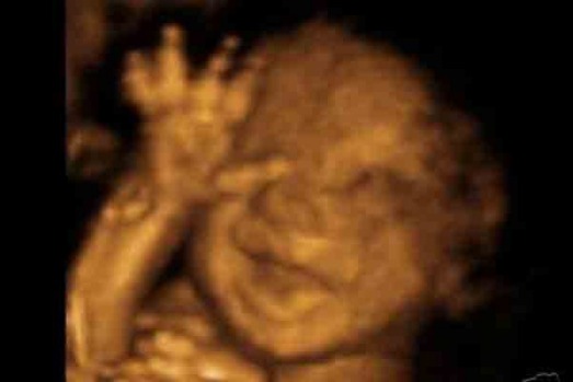 No pictures please! (<a href="http://mom.me/parenting/7022-funny-and-amazing-ultrasound-photos/item/40715-9/">img</a>)