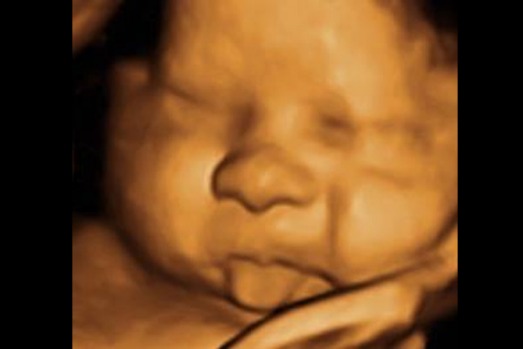 Blowing raspberries already (<a href="https://www.pinterest.com/uniqueultrasoun/3d-ultrasound-baby-pics/">img</a>)