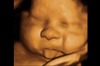 Blowing raspberries already (<a href="https://www.pinterest.com/uniqueultrasoun/3d-ultrasound-baby-pics/">img</a>)