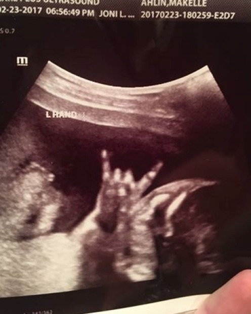 <b>FUNNY ULTRASOUND PICS:</b> <a href="http://www.lostboysarewe.com/">Blogger Makelle Ahlin</a> shared a photo of her ...