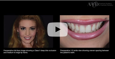 Continuing Education for Cosmetic Dentistry