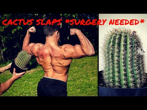 BODYBUILDER VS CACTUS SLAPS AND THROWS | Extreme Cactus Challenge Gone Wrong (HOME SURGERY)