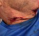 The injury that came within millimetres of Cam McIntyre's carotid artery.