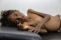 Five-year-old Mohannad Ali lies on a hospital bed in Abs, Yemen, in December. His two-year-old cousin died of hunger.