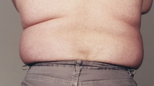 Obesity is a growing problem around the world.